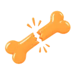 Перелом